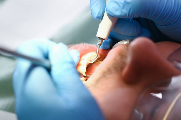 Best Pediatric Emergency Dentist in Willits, CA