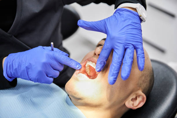 Best Emergency Dentist for Lost Fillings or Crowns in Willits, CA